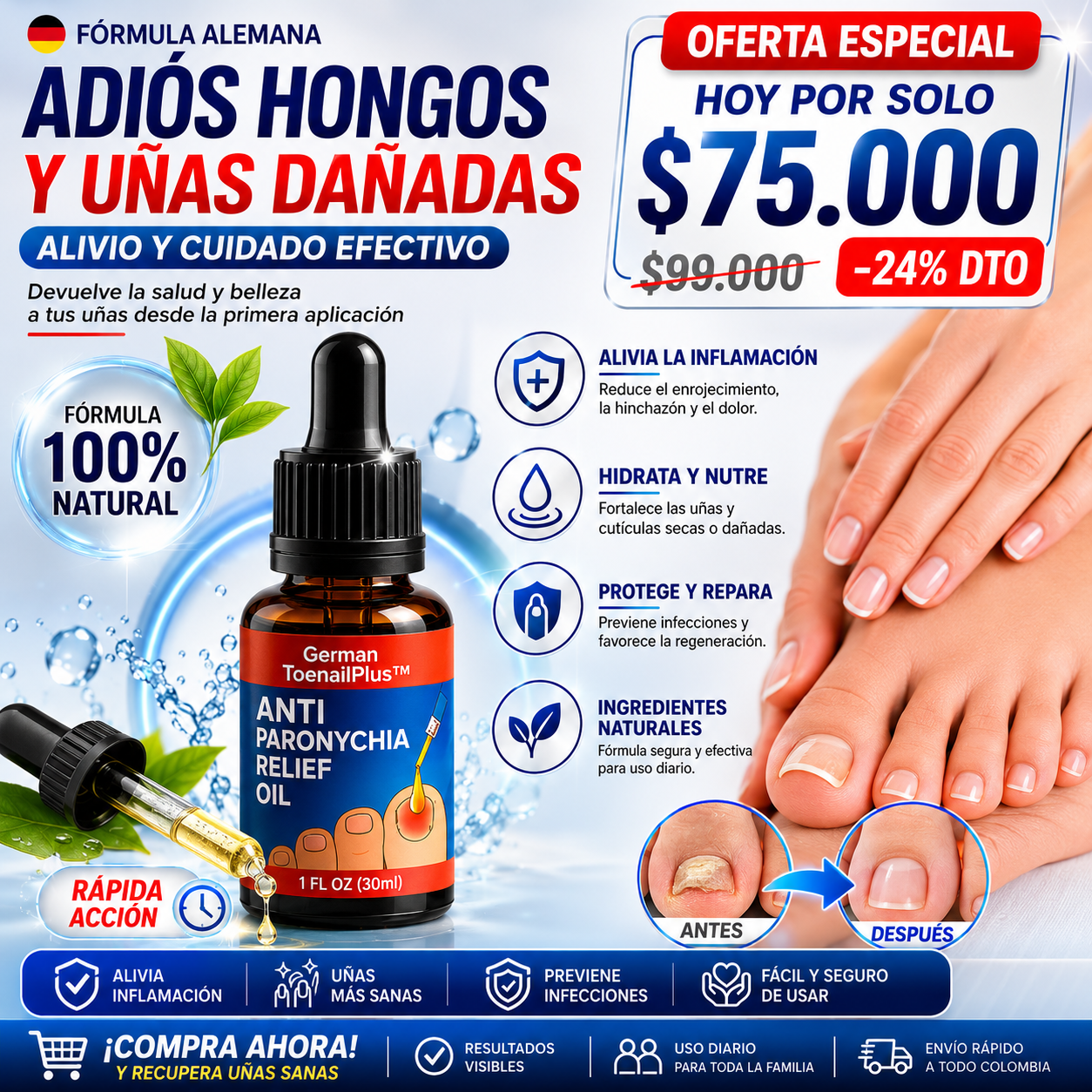 Aceite Removedor de Hongos en las Uñas