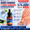 Aceite Removedor de Hongos en las Uñas